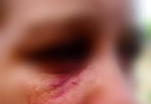 Filho pede socorro e PM resgata mulher mantida há anos em cárcere privado