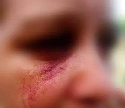 2kw35qdrb144c-e1774900094758